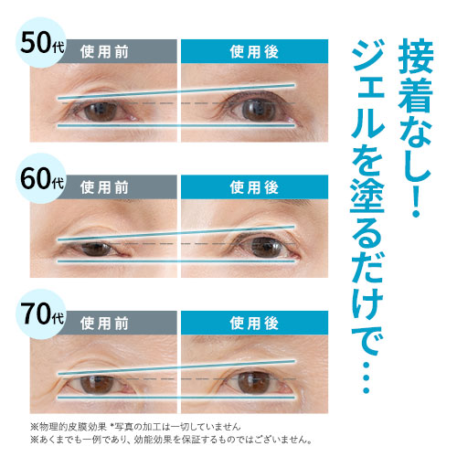 楽天市場】【10%OFFクーポン配布中】[3本セット]まぶた 引き上げ
