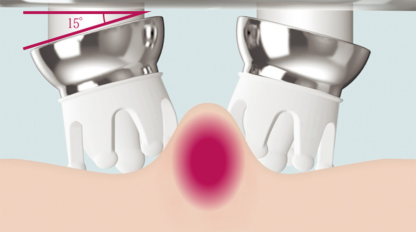 ReFa GRACE HEAD SPA | PRODUCTS | ReFa | MTG Co., Ltd.