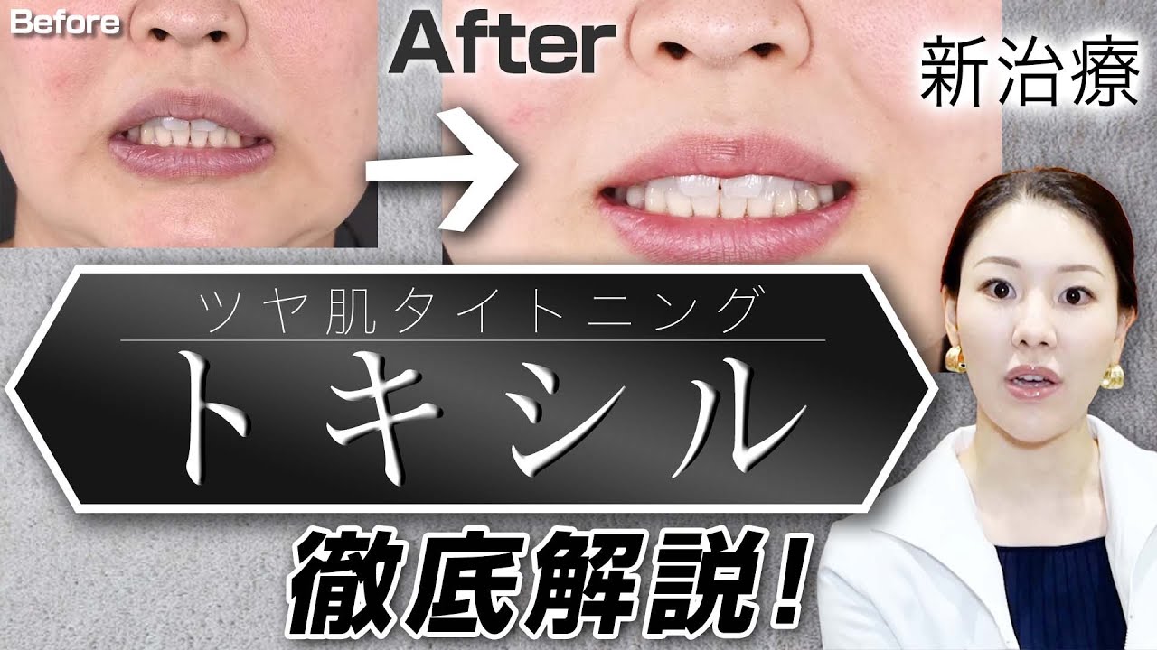 SBCトキシルスレッド～女優注射®成分配合～｜若返り・エイジングケア